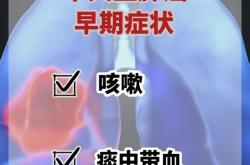 医生：肺癌不是只有烟民才会得 早期筛查至关重要